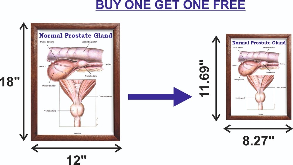 Normal Prostate Gland Chart 12x18 inches