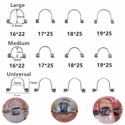 Dental Orthodontic Torquing Torque Spring Rectangular wire Single Anterior Teeth