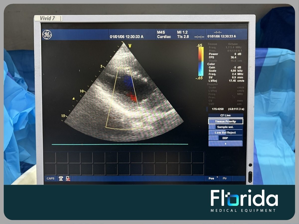 2012 GE M4S SECTOR ARRAY ULTRASOUND TRANSDUCER PROBE REF: 5129041 TESTED