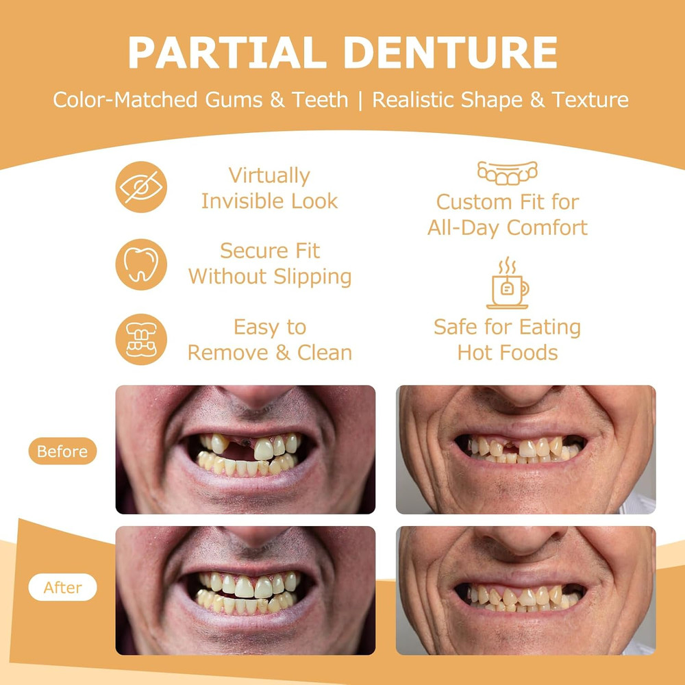 Partial Dentures - Dentures for Missing Teeth & Gaps - Lightweight & Unbreakable