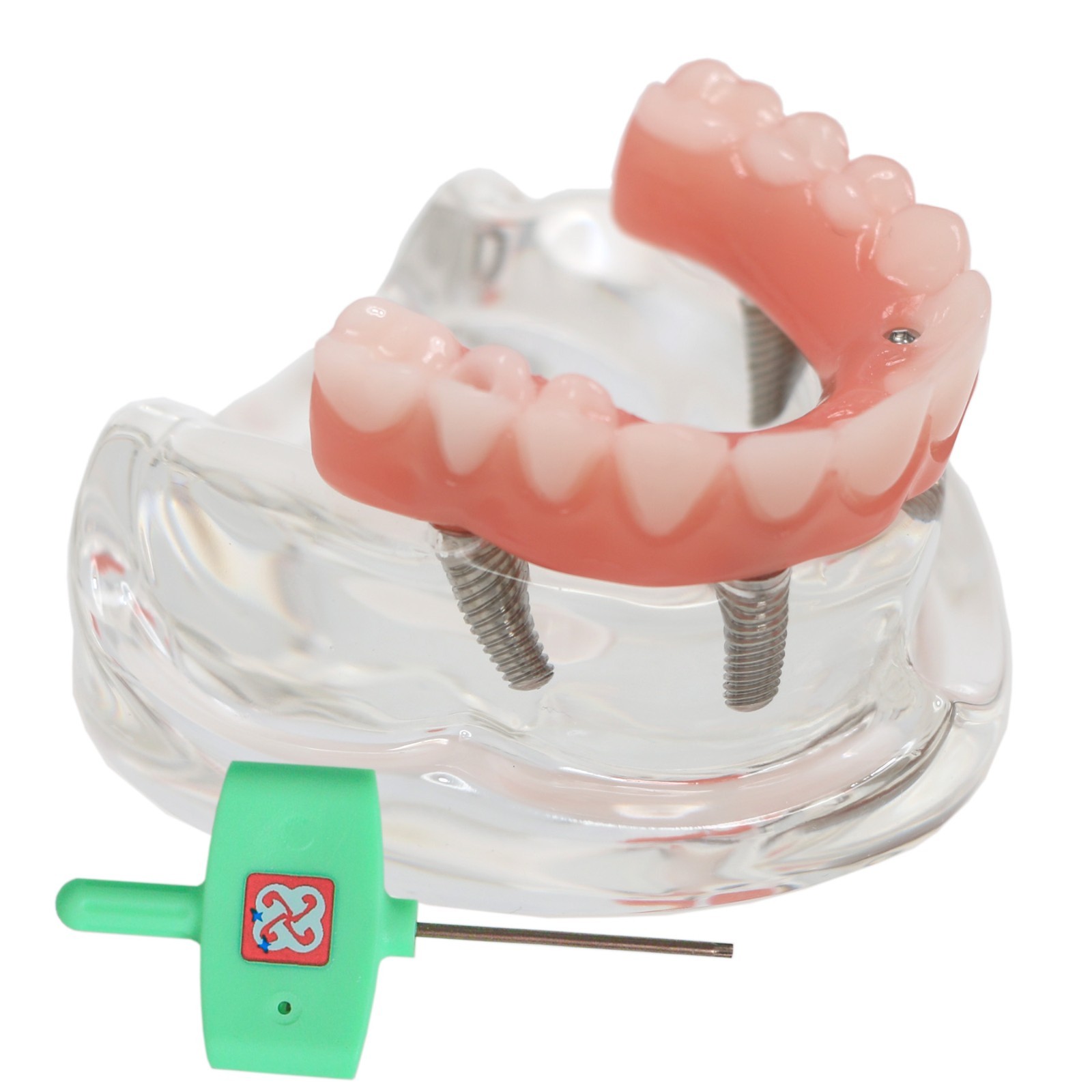 Implant Overdenture Al-on-4 treatment concept Demo Teeth Model Upper/4Srew Clear