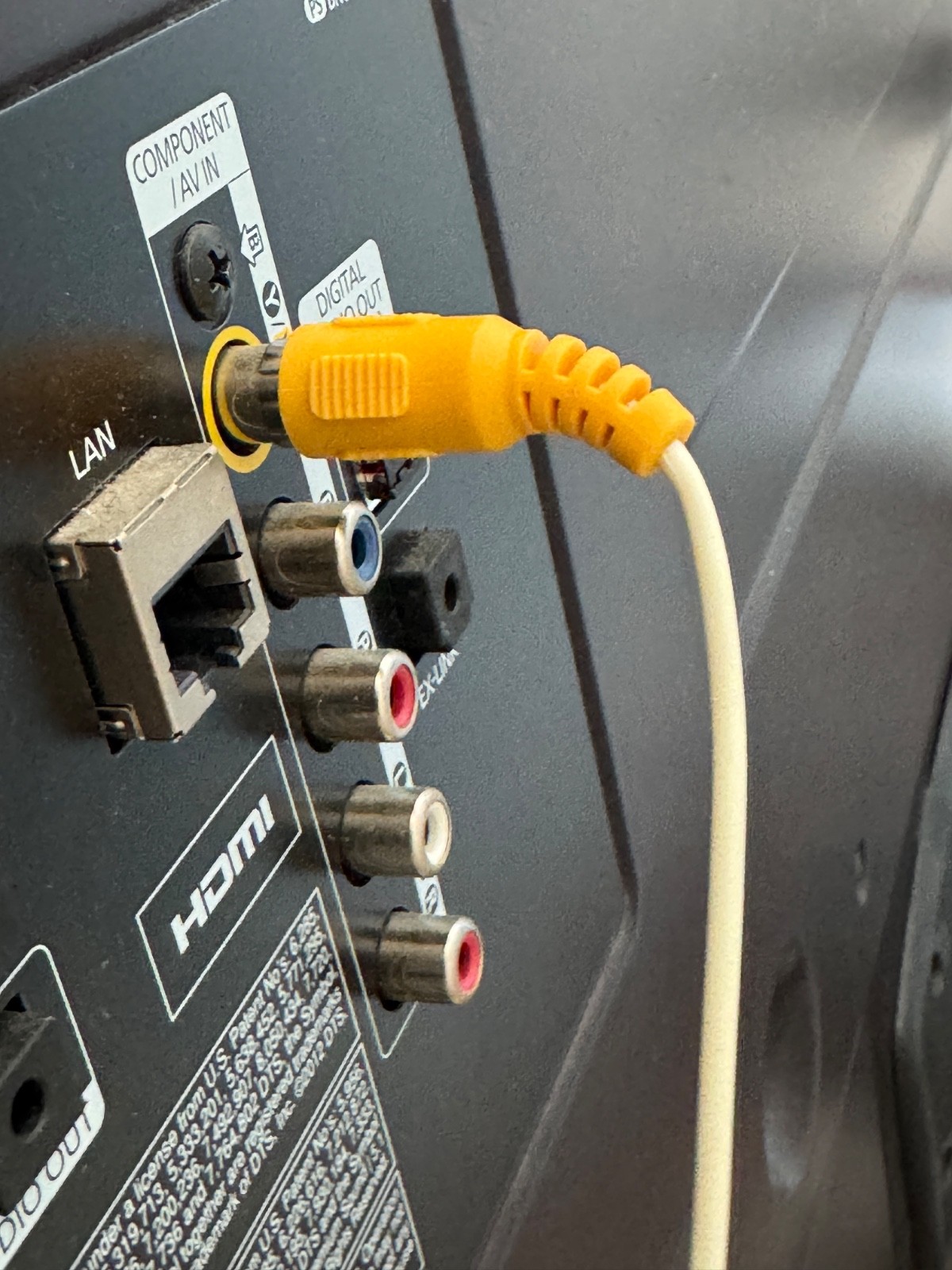 Miharu - Dental Intraoral Plaque Detection Camera Oral hygiene cleaning - RCA