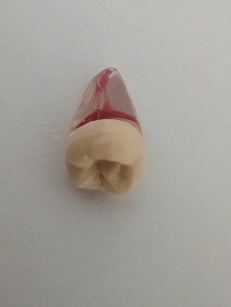 32pcs/Set Endodontic Teeth Model - Dental Practice Training Root Canal