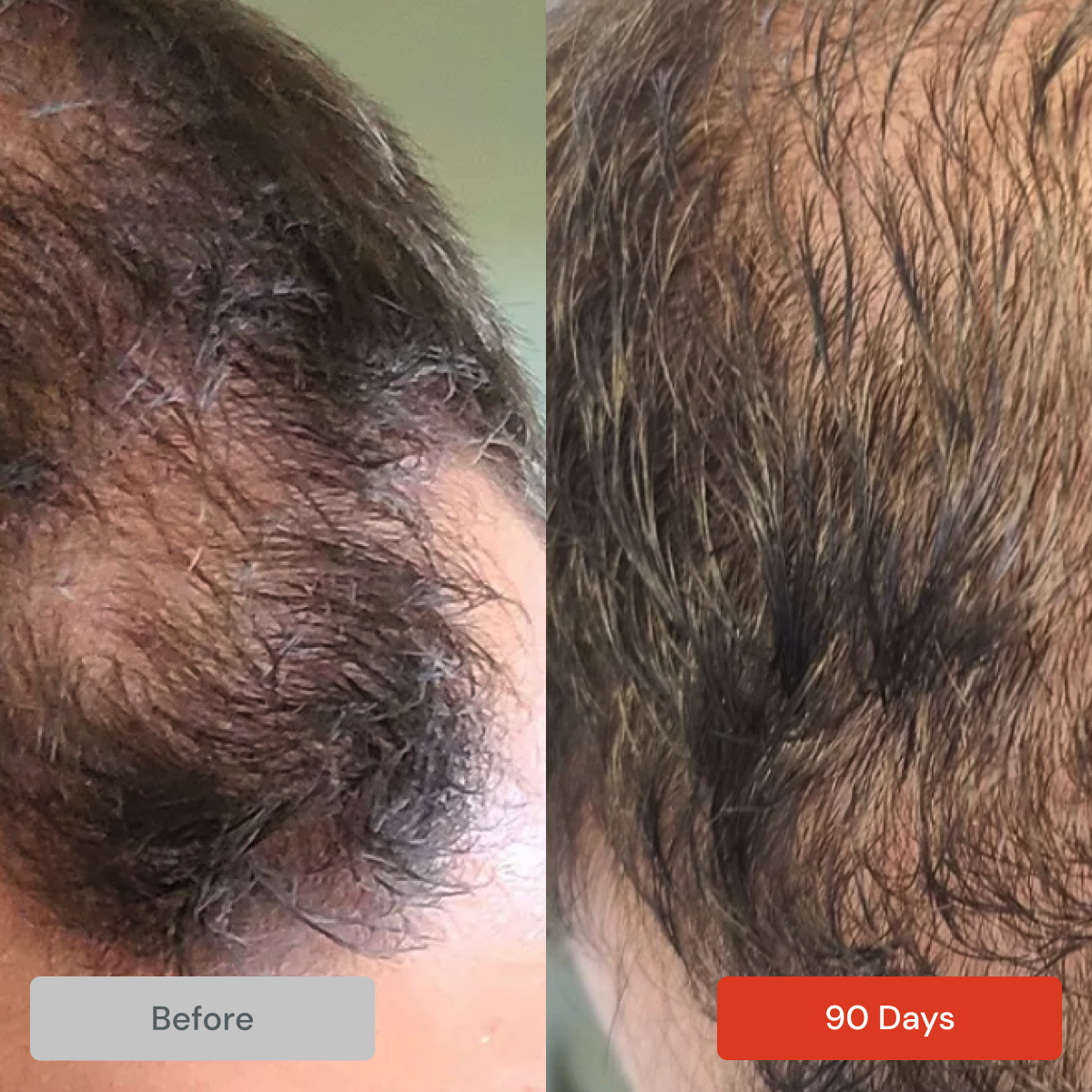 Spectral DNC-N® Redensifying w/ Nanoxidil by DS Laboratories