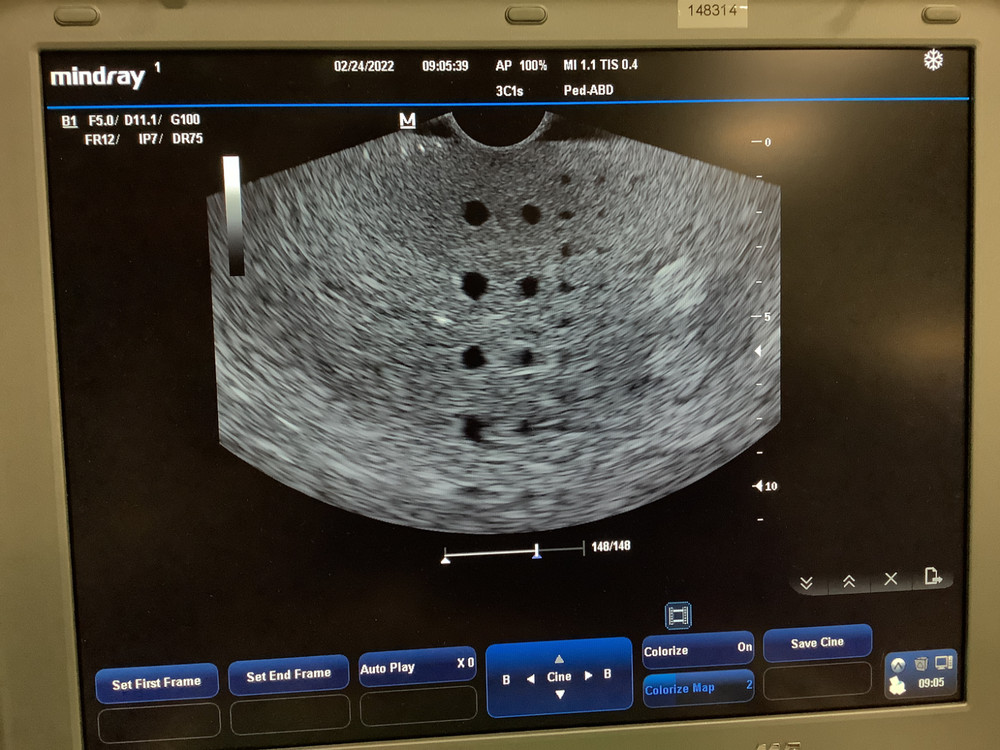Mindray 3C1s Convex Array Ultrasound Probe
