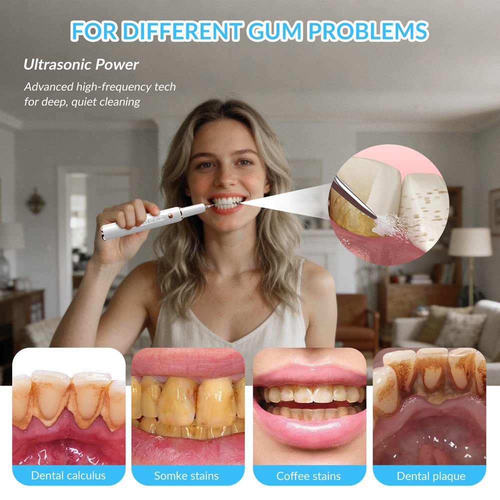 Precision Ultrasonic Dental Scaler with Adjustable Intensity Modes USB Powered