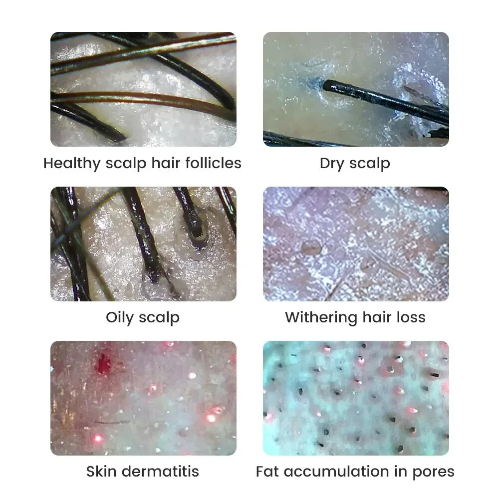 Digital Microscope WiFi Wireless Electron Dermatoscope Scalp Detection Pores