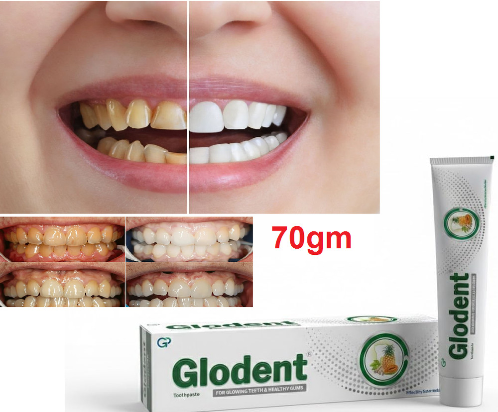 Glodent Herbal Toothpaste for teeth whitening & deep cleans 70 gm