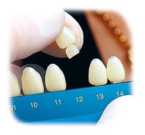 Dental Polycarbonate Temporary Crowns 5 pcs #68