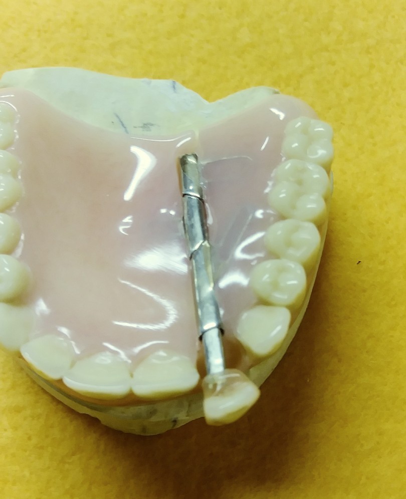 Devided Denture DENTAL DEMONSTRATION TEACHING MODEL Lab Dentist & Oral Surgeon