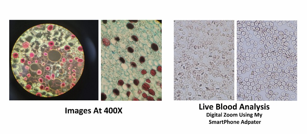 Cleaned & Lubed Biomed Phase Contrast Darkfield Microscope