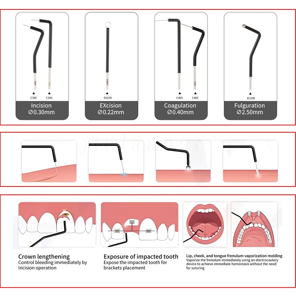 7 Knife Tips For Electro Electrosurgery Unit Machine High Frequency Electric CE