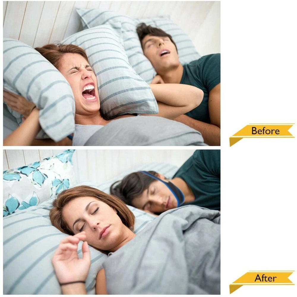 2 Pack Anti Snore Chin Strap Stop Snoring Belt Sleep Apnea Support Solution