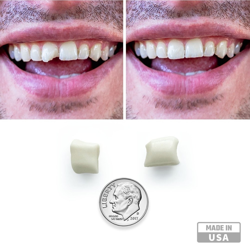 Imako® Tooth Tinted Plastic - Temporary Tooth - Fix Chipped Teeth, Gaps in Teeth