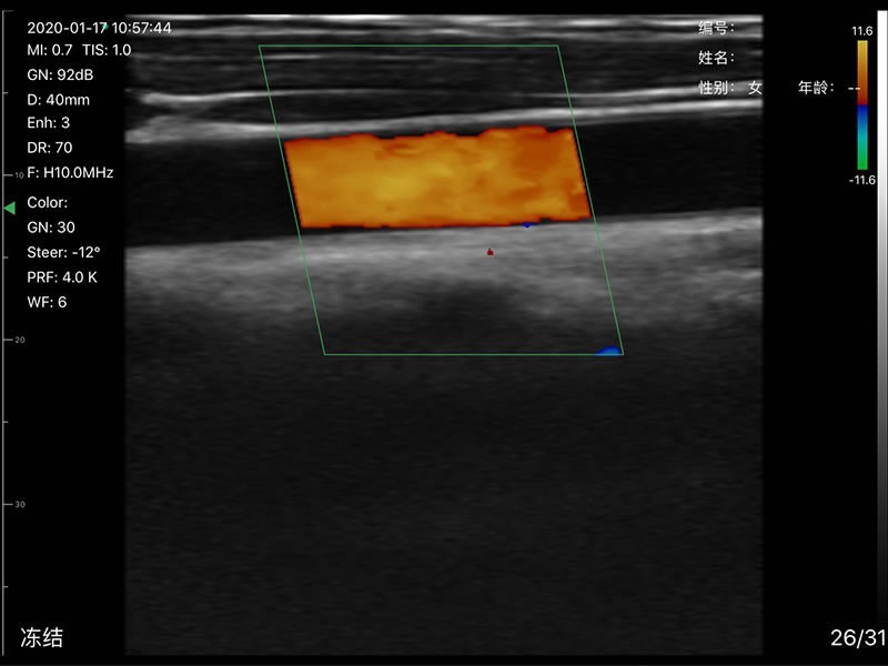 192 Elements convex/linear/phased array 3 in 1 Doppler Ultrasound Scanner