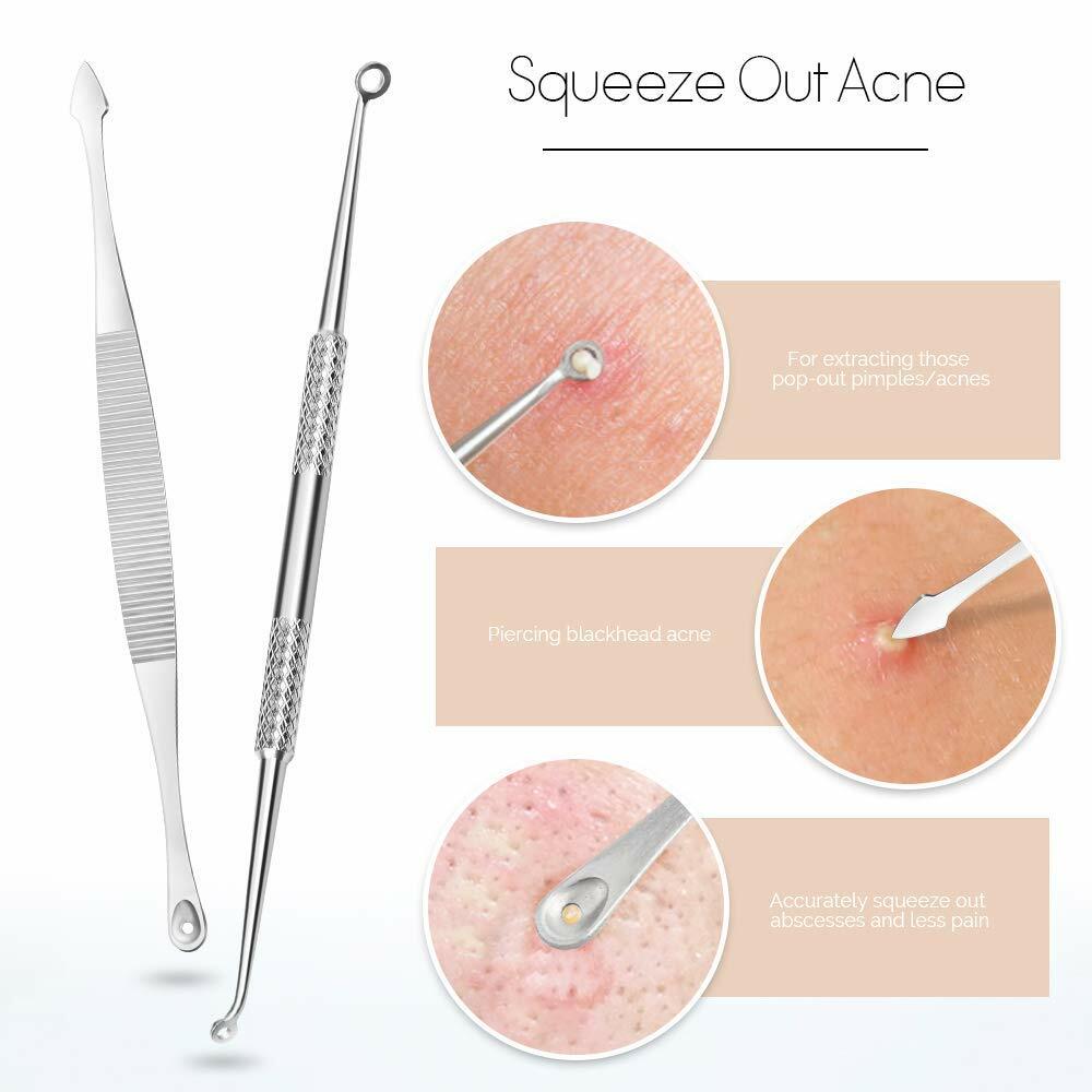 9pcs Pimple Popper Blackhead acne extractor Kit Dr Tool extraction Extractor