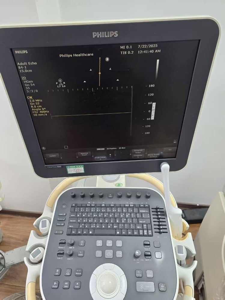 Philips S4-1 Transducer / Probe FOR CLEARVIEW