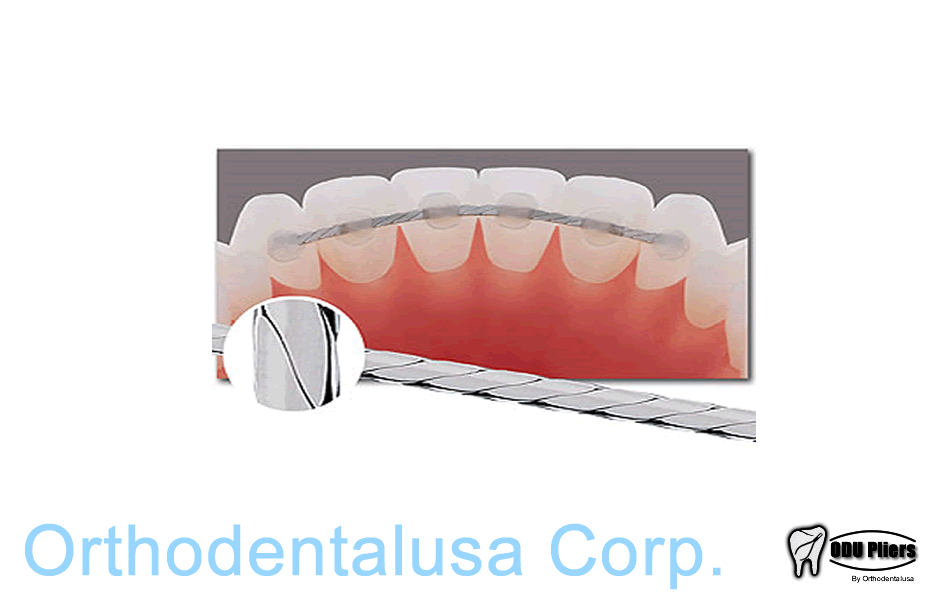 Flat Lingual RETAINER Titanium Single Strand. Size 10"x28" 6 inch (152mm) 10 pcs