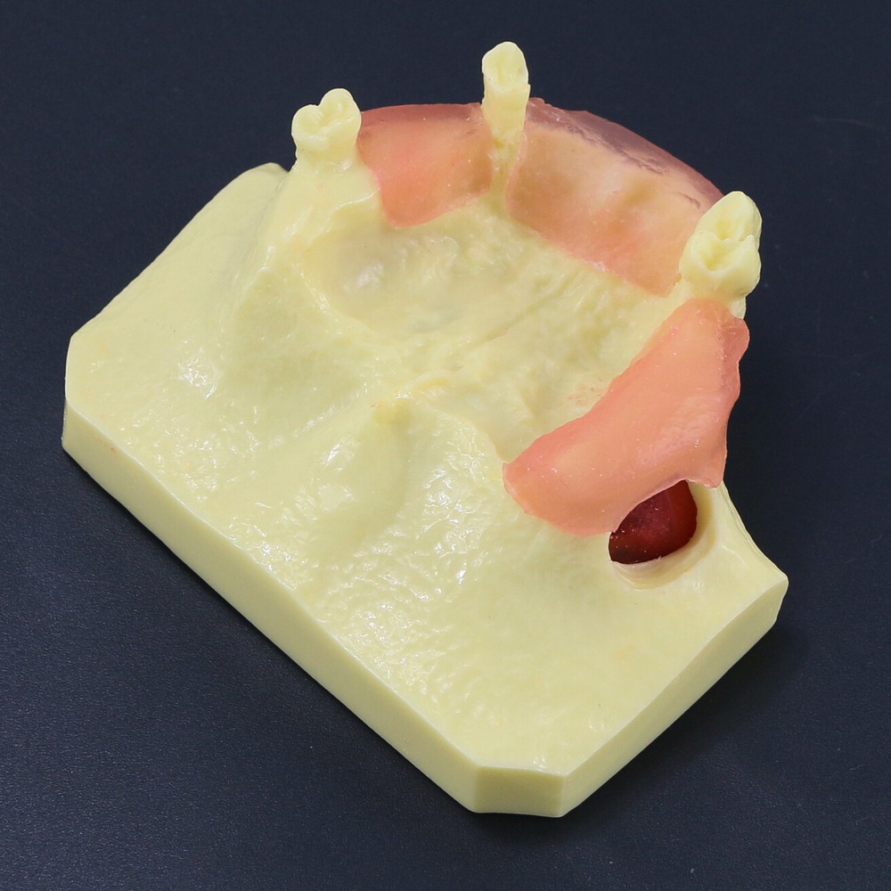 Dental Typodont Teeth Model Sinus Lift Practice Study Teach Demo Model 2012 2013