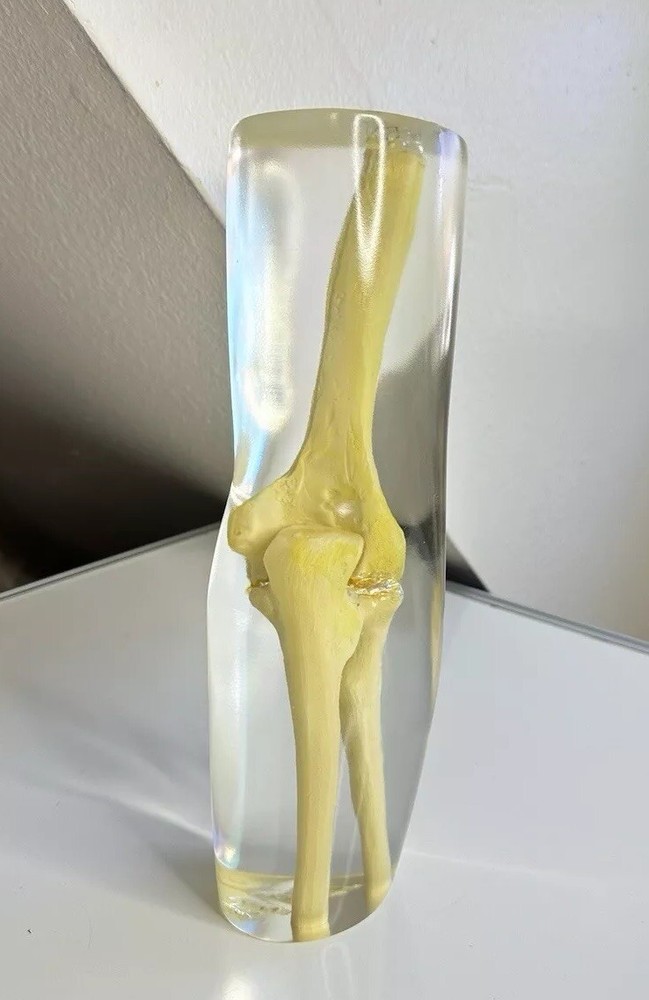 RSD Phantoms Natural Transparent Mannequin Elbow (Testing & Calibration)