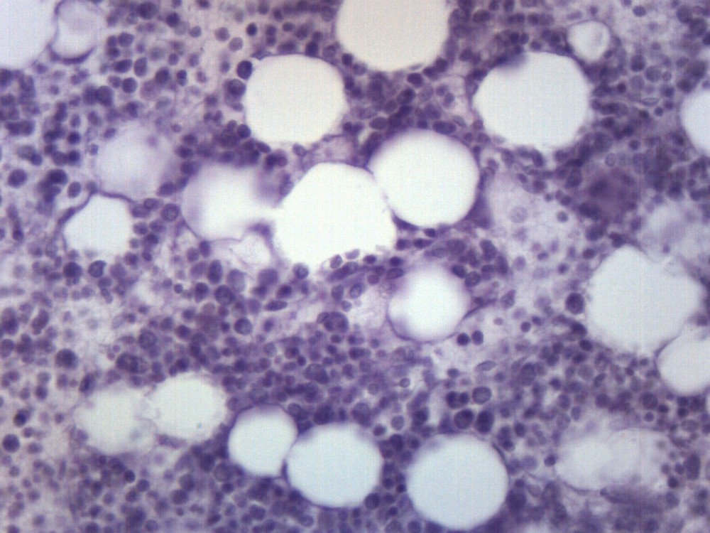 Red Bone Marrow Section - Prepared Microscope Slide - 75x25mm - Eisco Labs