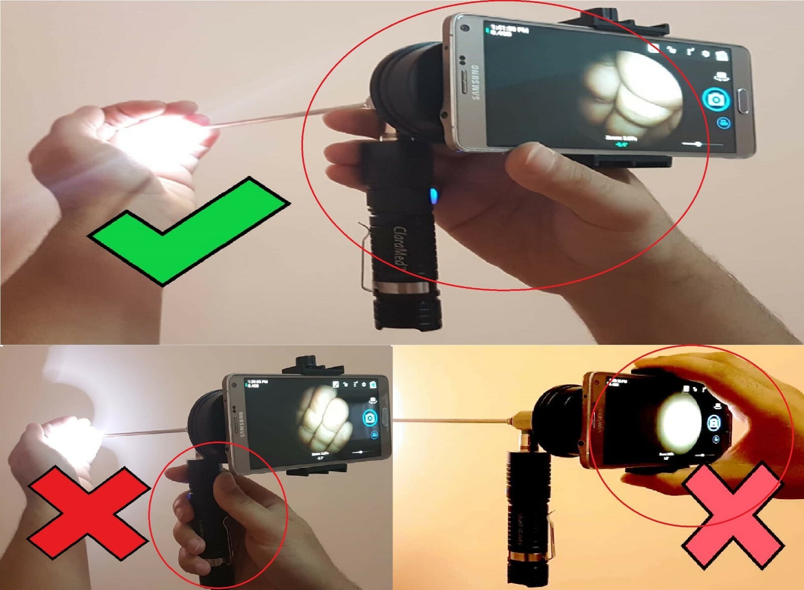 ClaraMed phone endoscope adapter with Olympus compatible LED light source S3