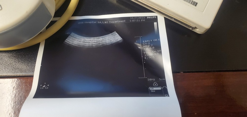 Philips Ultrasound Transducer Active Array C5-2 - Free Shipping