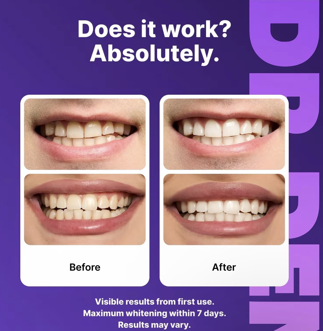 DR.DENT Purple Teeth Whitening Strips 14Ct Peroxide Free