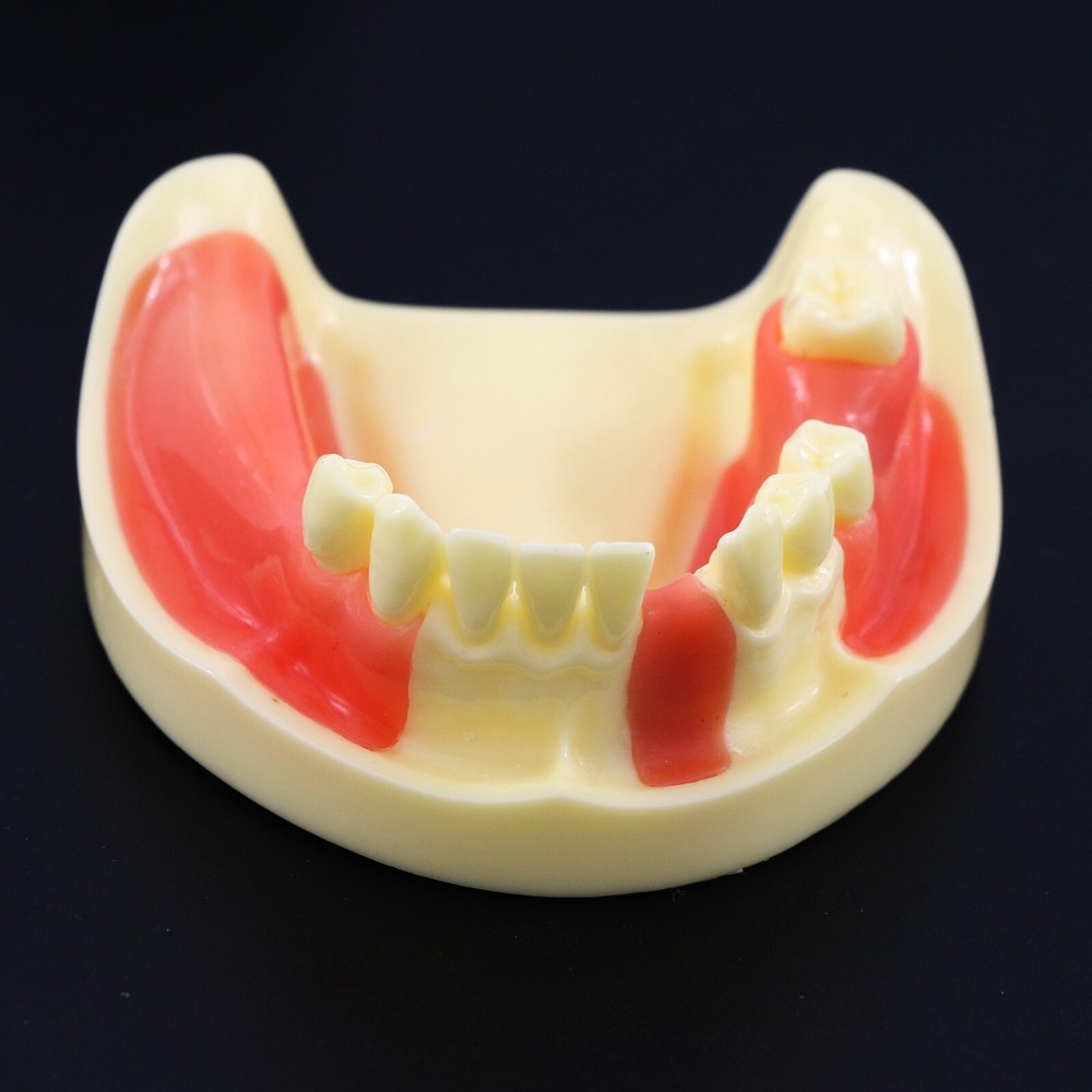 Dental Implant Practice Teeth Model Cutting Suturing Typodont M2004