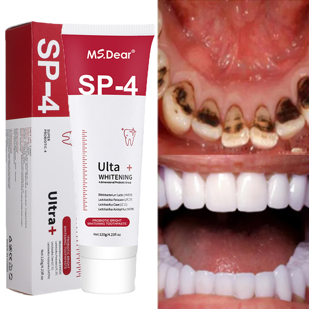 Sip-4 Toothpaste, Whitening Sp-4 Toothpaste, Sp-4 Probiotic Whitening Toothpaste