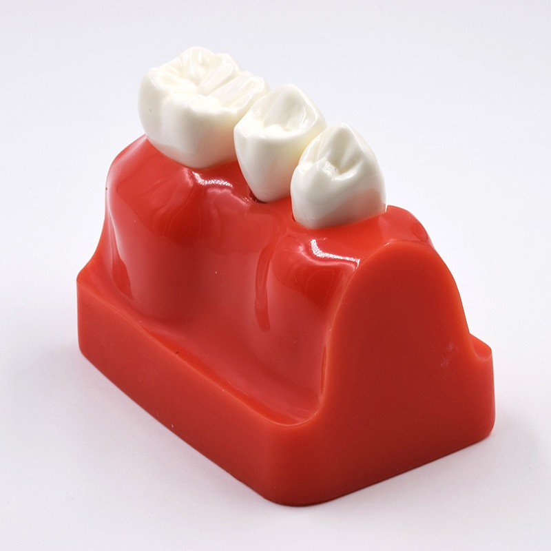 Dental Implant Analysis Crown Bridge Demonstration Teeth Study Model Typodont