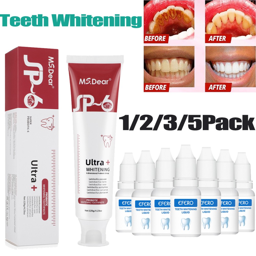 SP-6 Probiotic Toothpaste,Sp-6 Toothpaste Whitening Quick White Toothpaste 2026
