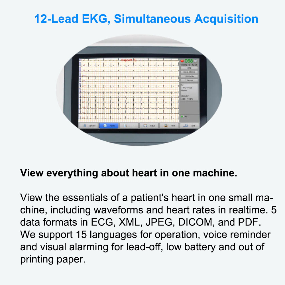 Biocare 12 lead ECG Machine Portable with Au-to Analysis Diagnosis ECG, Printer