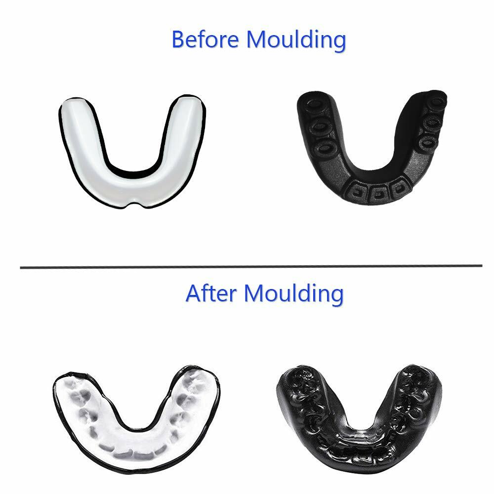 Mouth Guard Teeth Gum Shield Boxing MMA Grinding Sports Rugby Gel MouthPiece DSM
