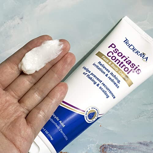 TriDerma Psoriasis Control Face and Body Cream, Cortisone-Free 4.2 Ounces