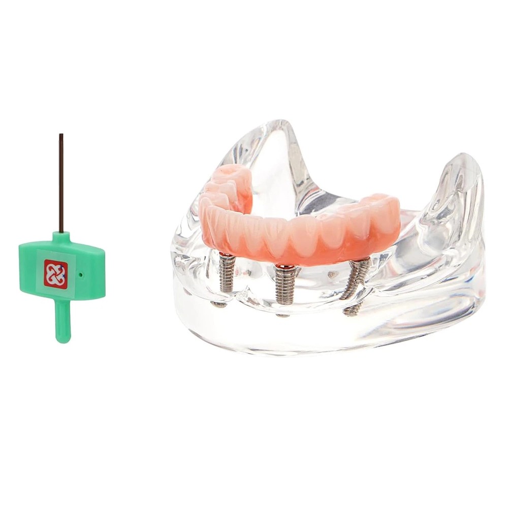 Dental Implant Model Dental Simulator Teeth Model Upper & Lower Teaching Model