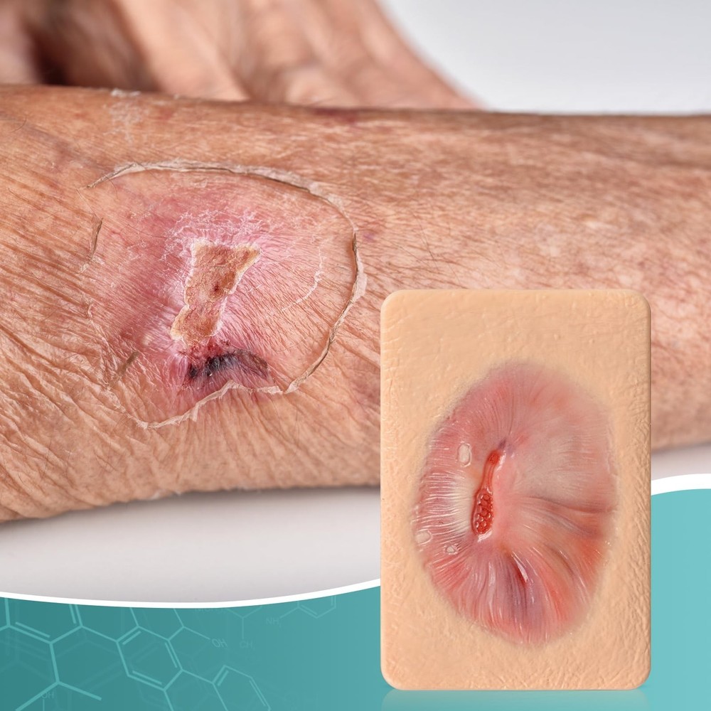 Granulation Wound Packing Trainer, Palm Sized Wound Simulation Models for Med...