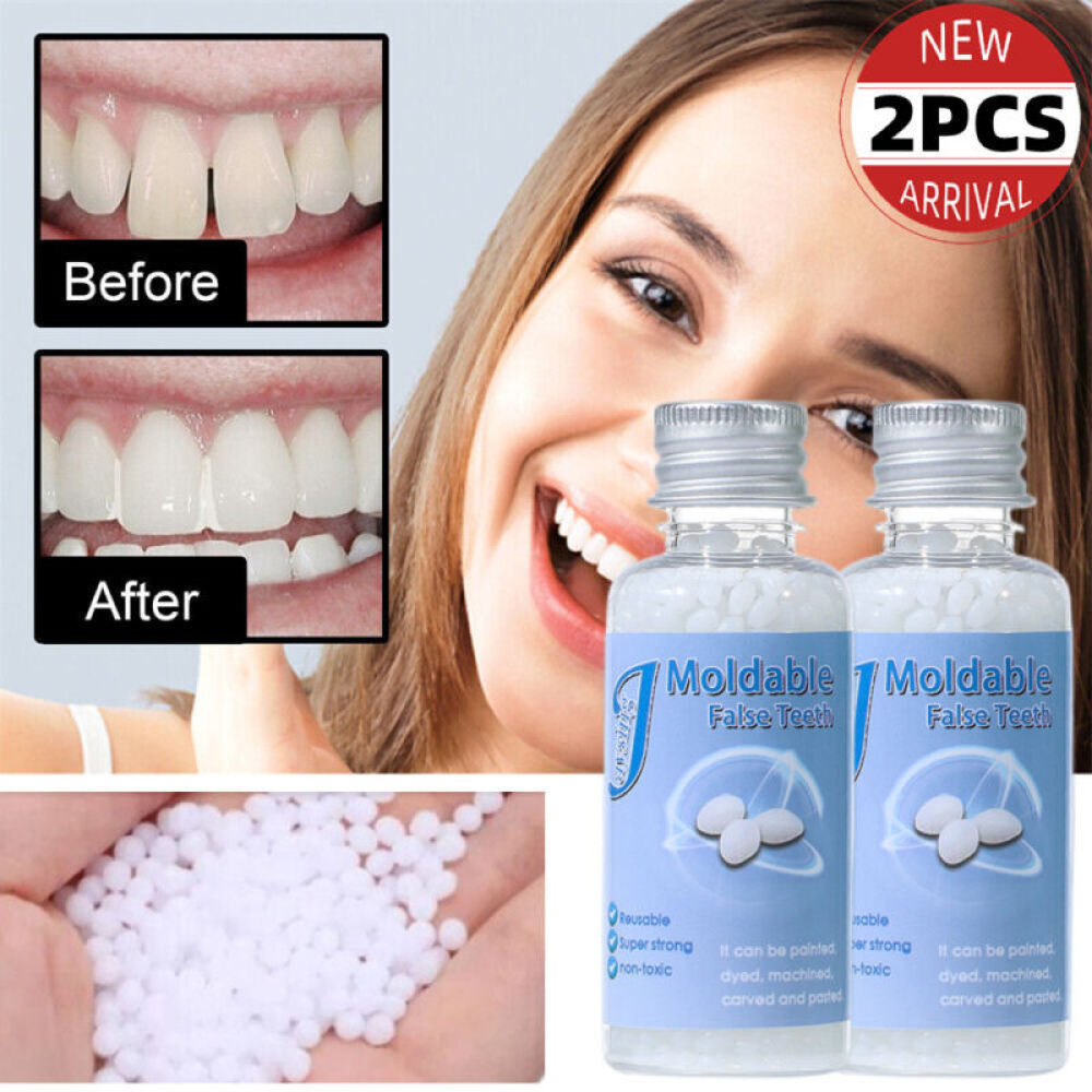 2~ Tooth Repair Kit - Temporary Teeth Replacement Kit for Missing & Broken Teeth