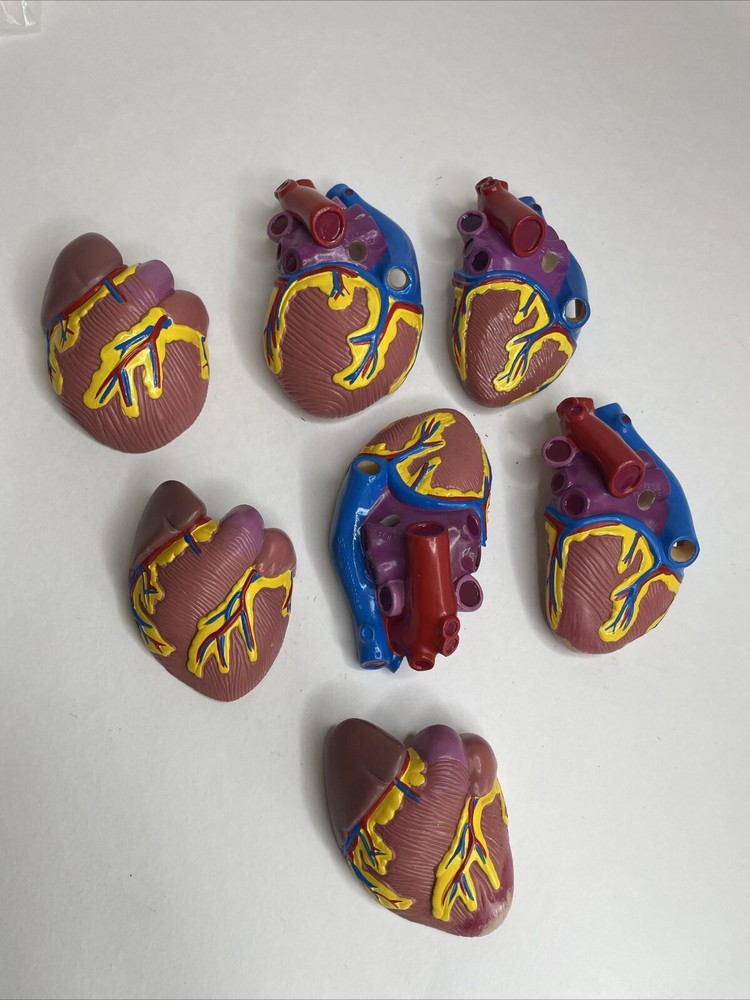 7pc Diabetes Type 2 Anatomical Model GPI Education Clinical Replacement A7