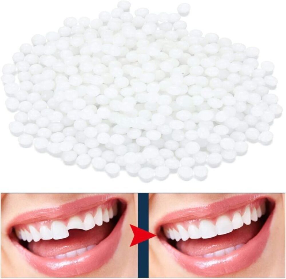 Tooth Repair Kit Temporary Teeth Replacement Beads for Missing & Broken Teeth
