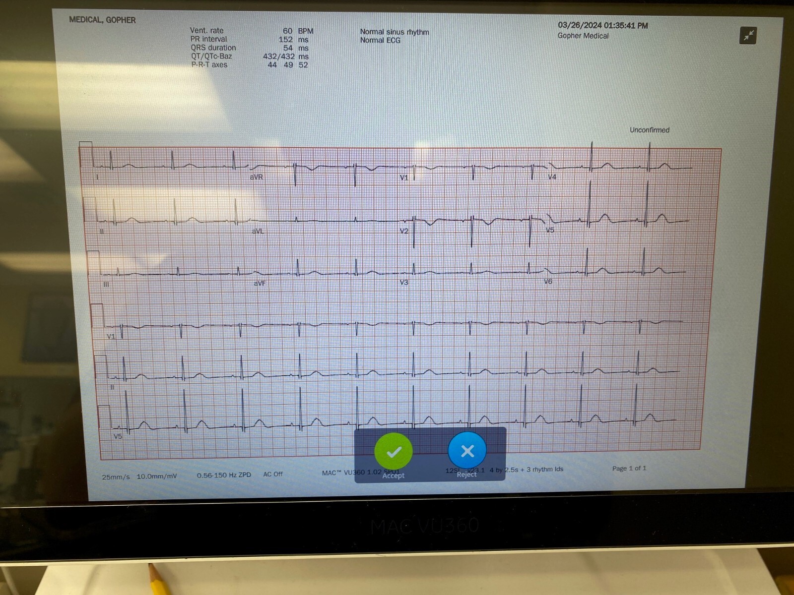 GE CAM Connect 14 Module 2091686-001 Biomed Tested on Mac Vue360 with Warranty