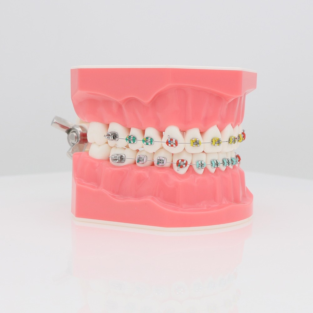 Dental Orthodontic Teeth Model Typodont Demonstration Model with Brackets