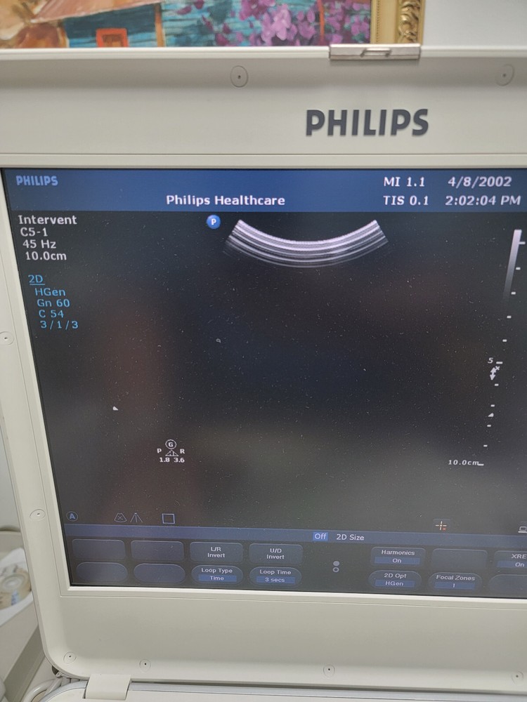 Portable Ultrasound