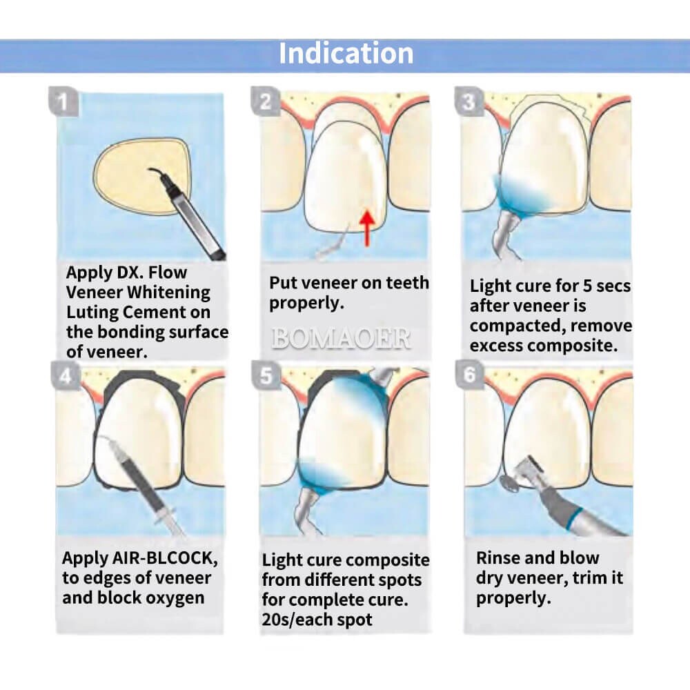 Dental Light Cure Kit: Flowable Composite Resin & Luting Cement, U.LINK BASE