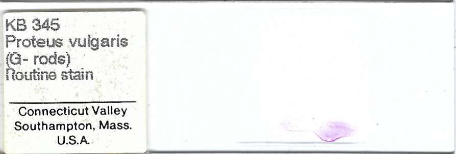 Proteus vulgaris Microscope Slide