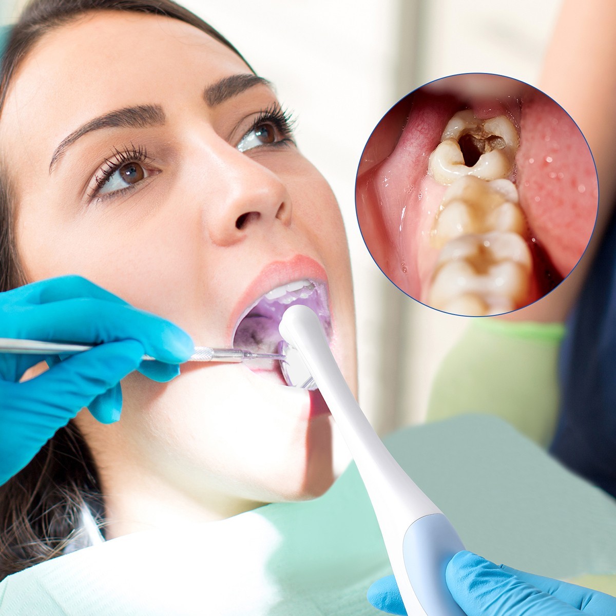 AZDENT Dental Intraoral Camera Digital USB Imaging Focus Intra Oral 8 LED Light