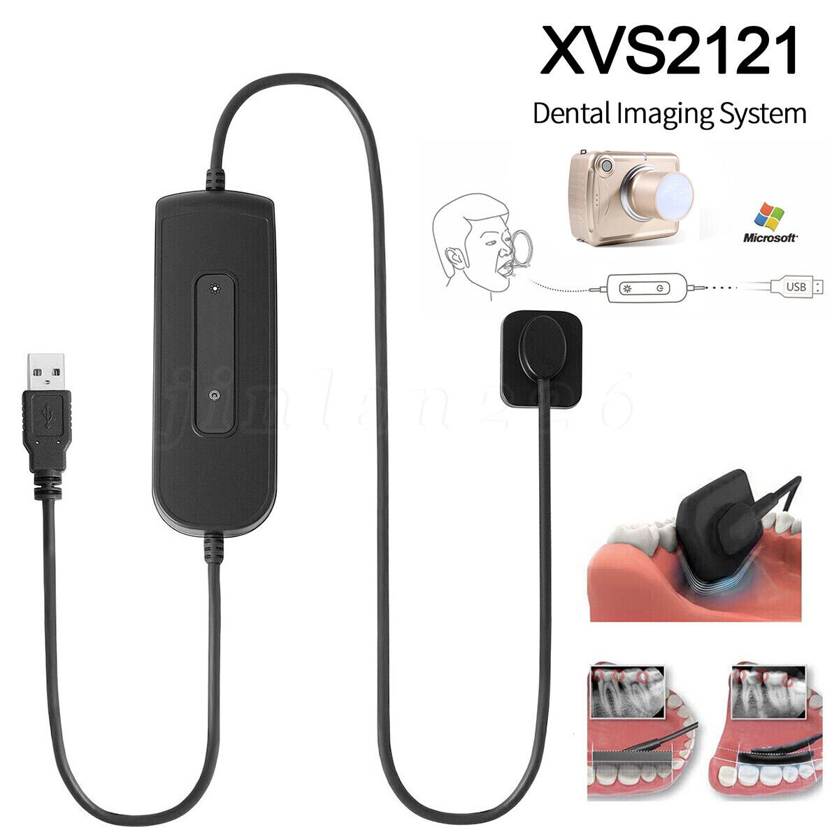 Woodpeckr Dental Digital Rayos X Sensor Intraoral ray HD Sensor Size 1.0 Kids