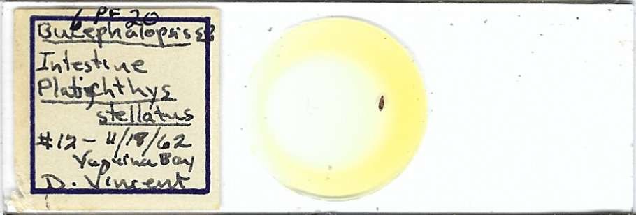 Bucephalopsis w.m. from Starry Founder Intestine Microscope Slide