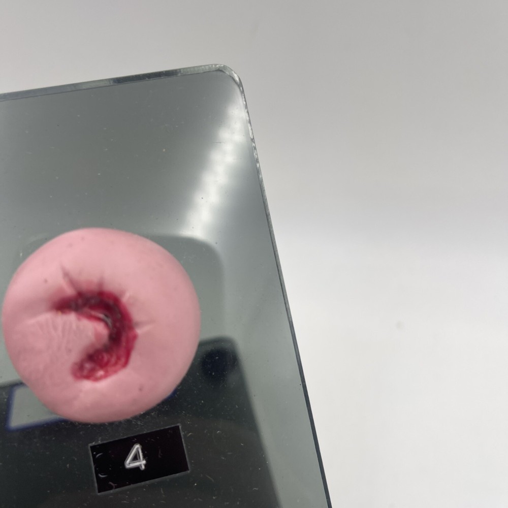 Gaumard S505 Cervical Pathologies Model Pathology Anatomical Ob/Gyn Cervix