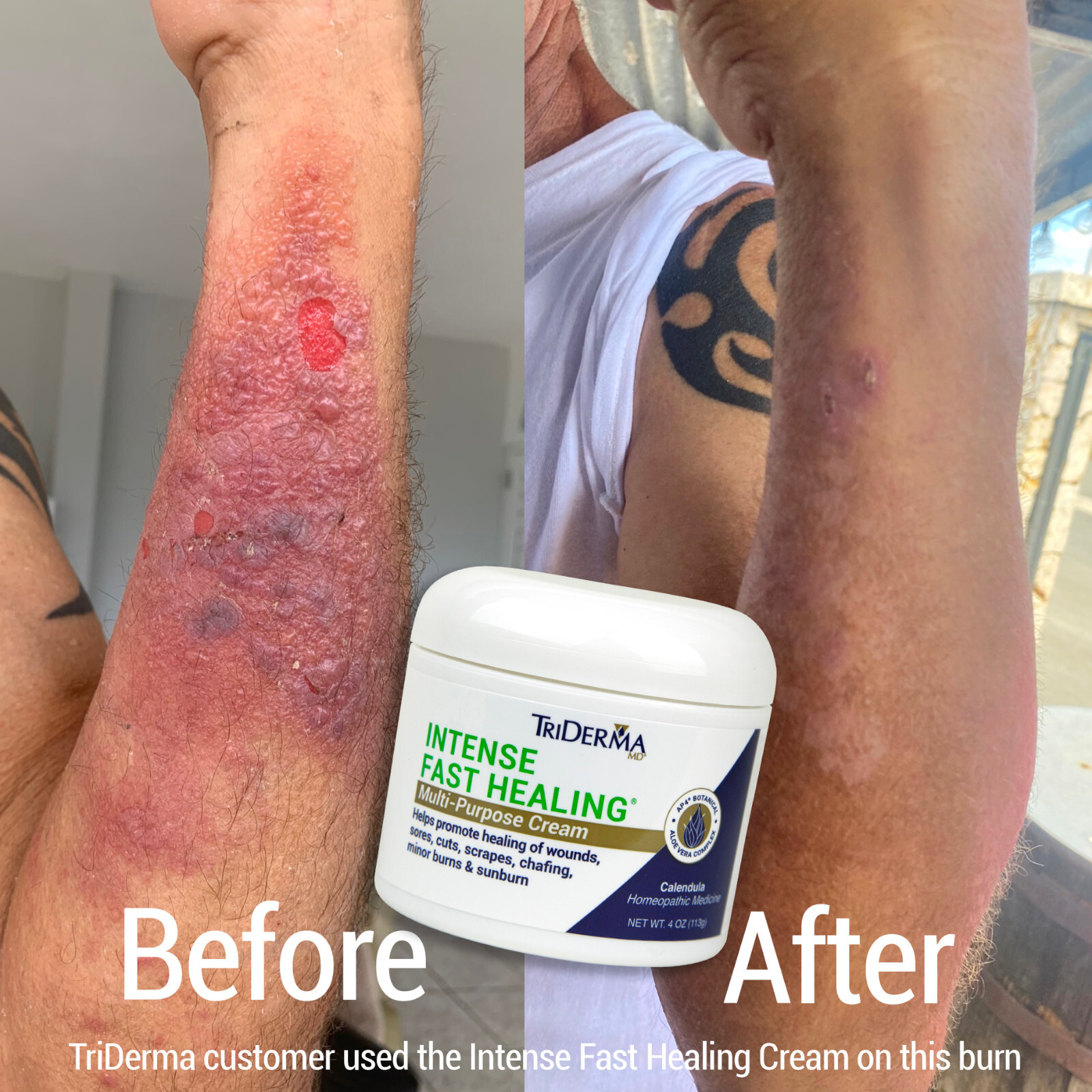 TriDerma Intense Fast Healing Multi-Purpose Cream (4 oz)